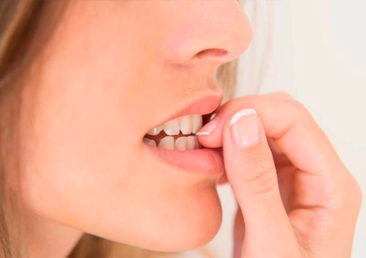 ‘Morderse las uñas’ y otras manías que podrían arruinar tu salud y belleza