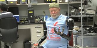 Hombre amputado con brazos bionicos